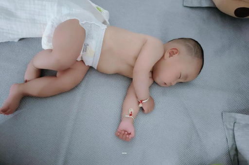 诸暨宝宝脸上有白色斑块